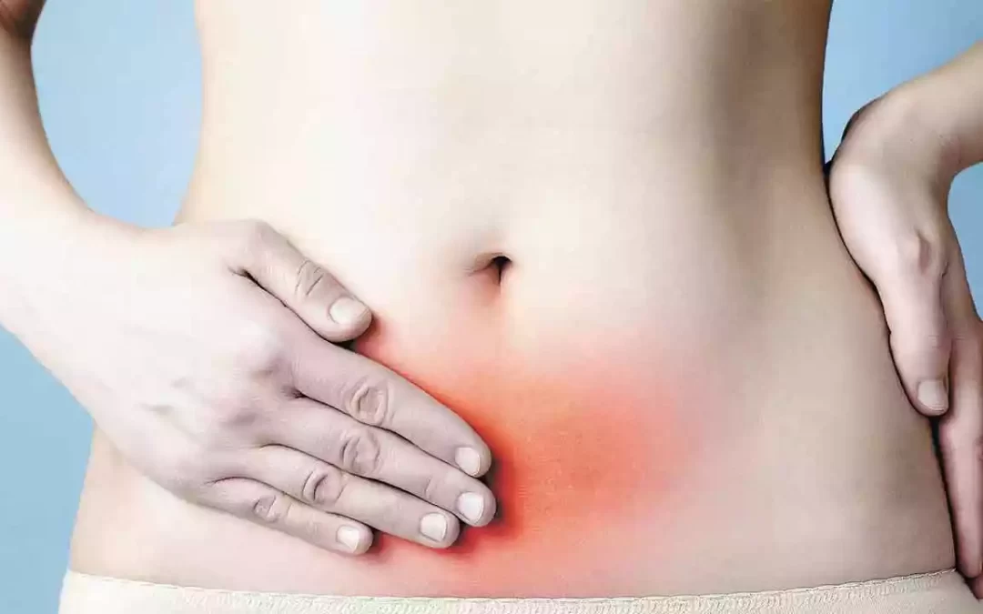 Endometriose: o que é essa doença?