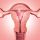 Endométrio e fertilidade