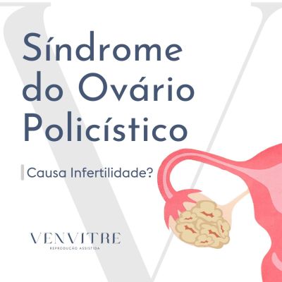 Síndrome do Ovário Policístico