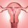 Endométrio e fertilidade